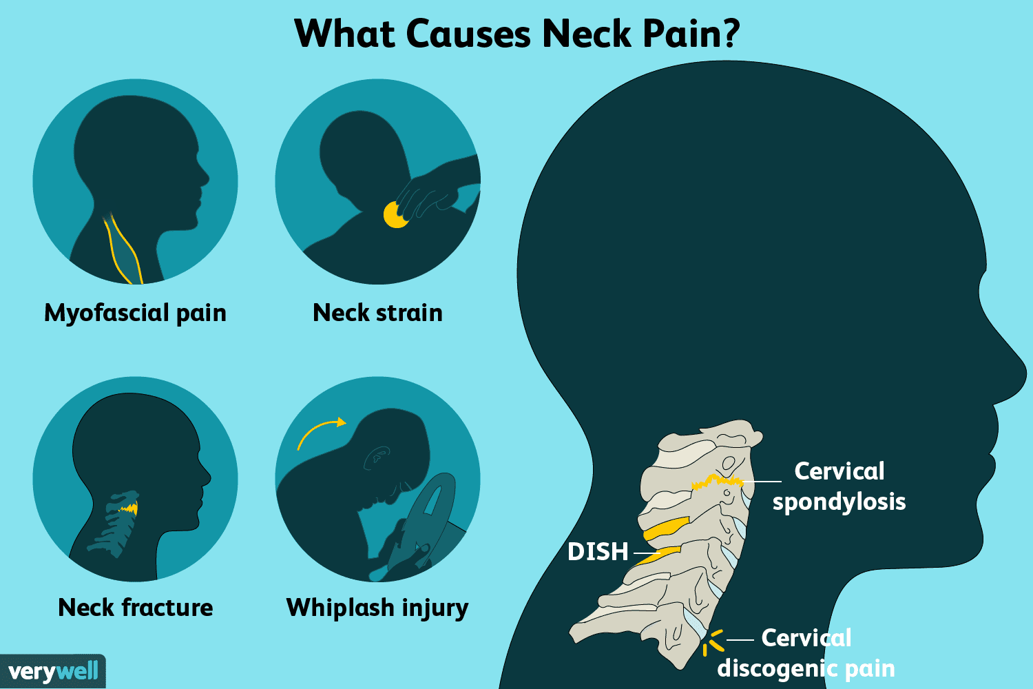 neck pain treatments